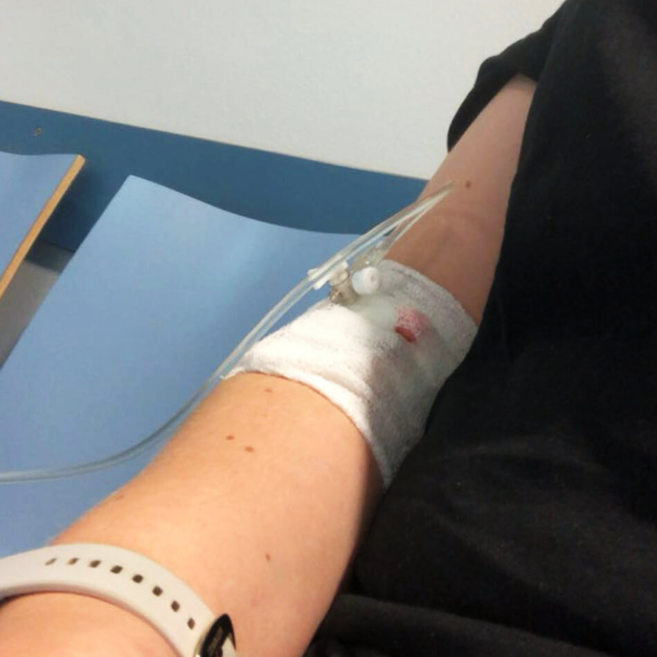 Viktorias Arm, in dem eine Infusion steckt mit Verband drumherum
